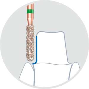 KP6881-Алмазные боры с керамическими жемчужинами DIAO Komet Dental (Комет Дентал)