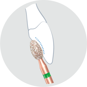 KP6379-Алмазные боры с керамическими жемчужинами DIAO Komet Dental (Комет Дентал)