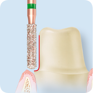 KP6837KR-Алмазные боры с керамическими жемчужинами DIAO Komet Dental (Комет Дентал)