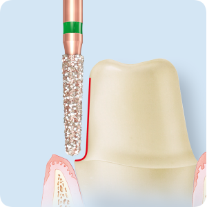 KP6847KR-Алмазные боры с керамическими жемчужинами DIAO Komet Dental (Комет Дентал)