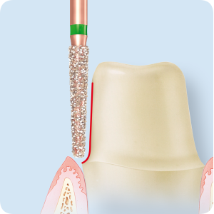 KP6850-Алмазные боры с керамическими жемчужинами DIAO Komet Dental (Комет Дентал)